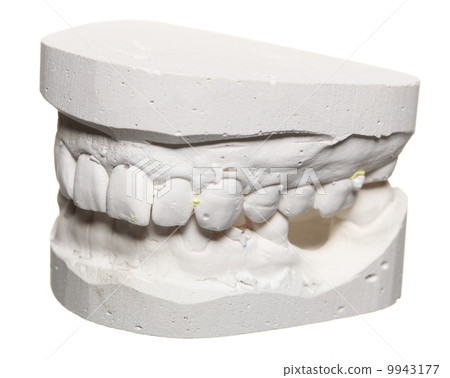 Dental gypsum model mould of teeth in plaster 9943177