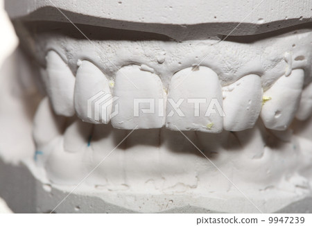 Dental gypsum model mould of teeth in plaster 9947239