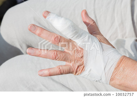 Ganglion cyst three days after surgery Ganglion cyst three days after surgery 10032757