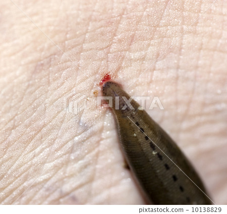 Blood sucking leech. Blood sucking leech. 10138829
