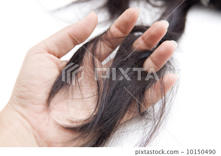 hair loss 10150490