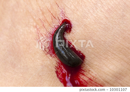Blood sucking leech. 10301107