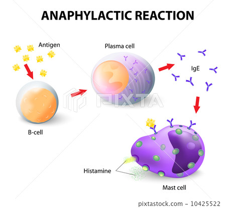 allergy and anaphylaxis 10425522