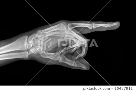 Roentgenogram 10437911