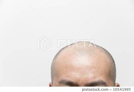 Hair growth image Thin haired male head Hair growth image Thin haired male head 10541995