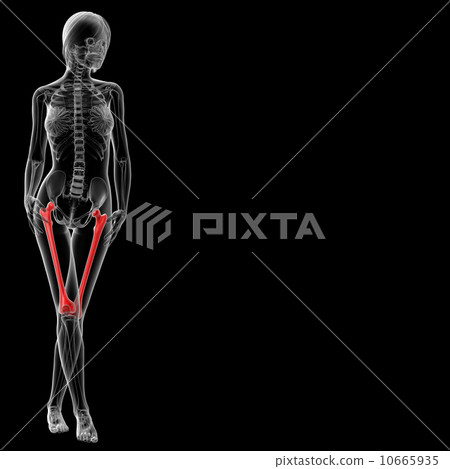 femur bone 10665935