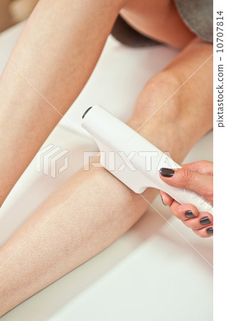 laser epilation laser epilation 10707814