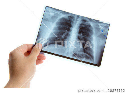 Male hand holding lung radiography 10873132