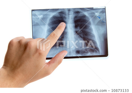 Male hand pointing on lung radiography 10873133