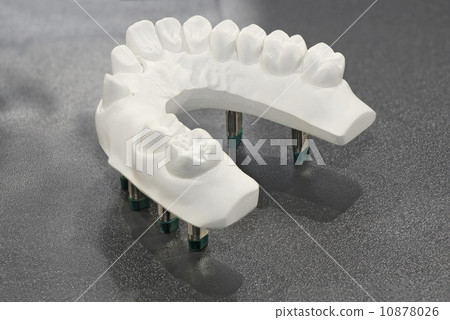 Plaster model of teeth Plaster model of teeth 10878026