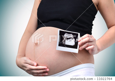 Pregnant woman Pregnant woman 11022764