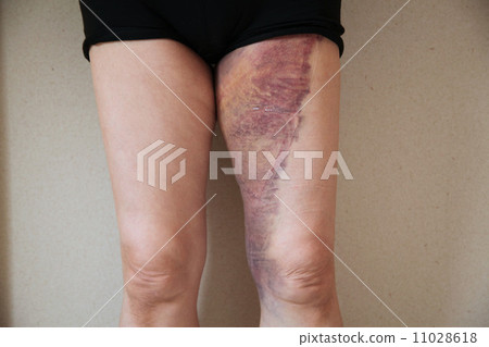 Stock Photo: injury, turning over, middle and old aged