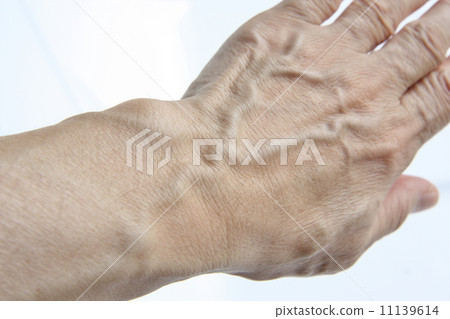 A thick blood vessel of the back of the hand ⑨ 11139614