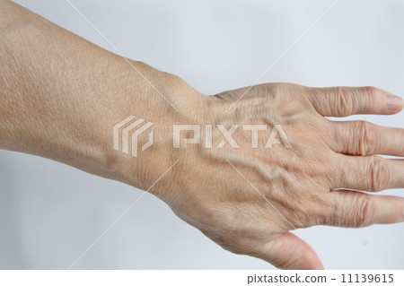 Blood vessels of the back of the hand ⑩ 11139615