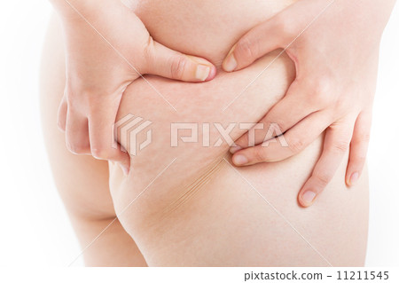 Cellulite of a woman in her 30's 11211545