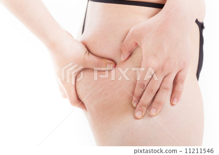 一個30多歲的女人的橘皮組織 11211546