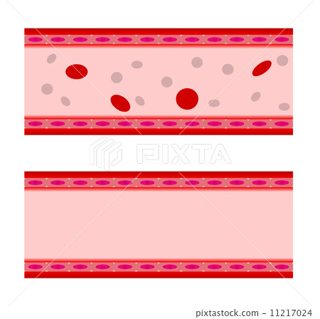 Simple vessel 11217024