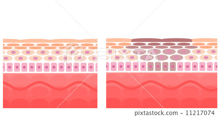 皮肤 剖面图 整容术