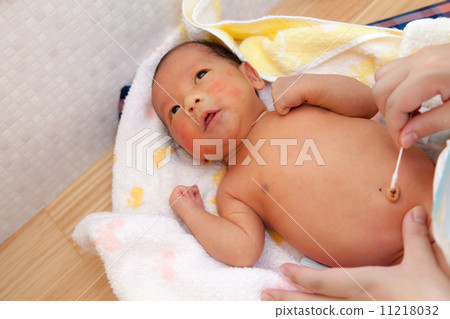 寶寶的肚臍護理3周大 11218032