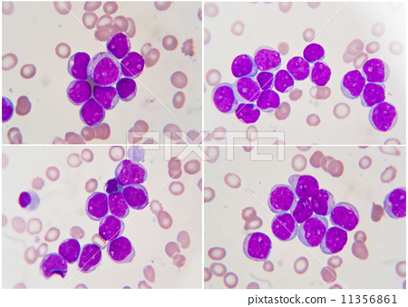 Microscope 1000x Blood Under Microscope - Micropedia