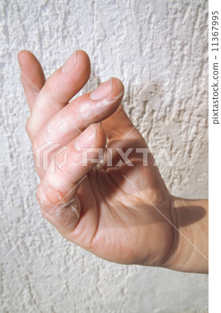 Scald on Fingers 11367995