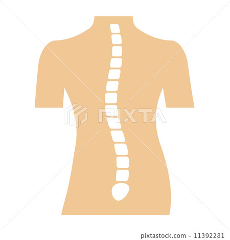 Distortion of the spine Distortion of the spine 11392281