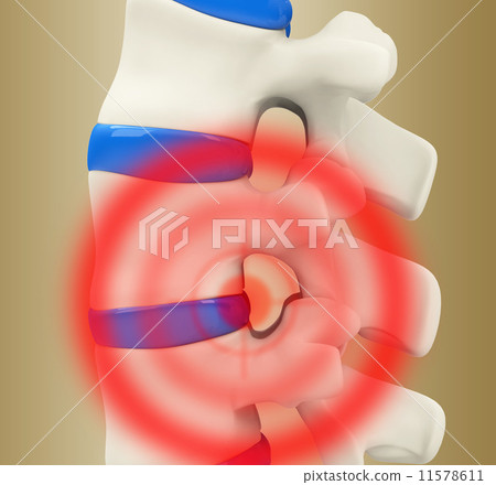 Backbone Backbone 11578611