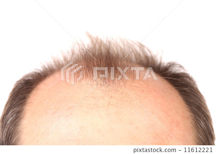Bald men. 11612221