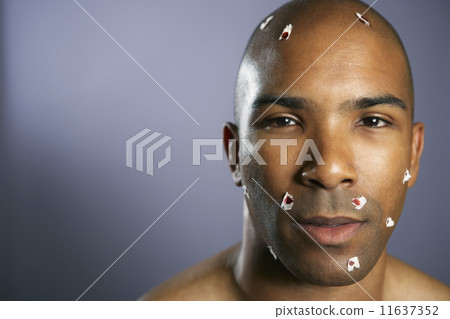 African American man with shaving cuts 11637352