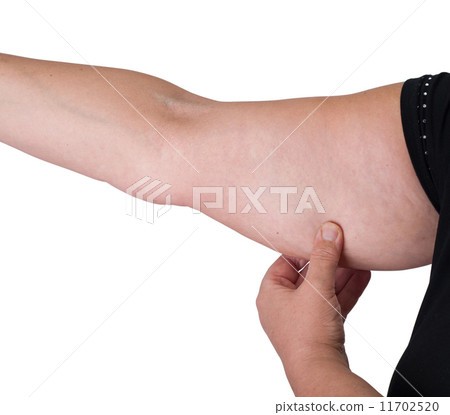 arm fat arm fat 11702520