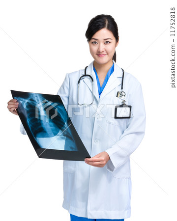 Asia female doctor hold x ray Asia female doctor hold x ray 11752818