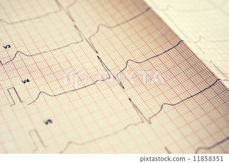Electrocardiogram 11858351