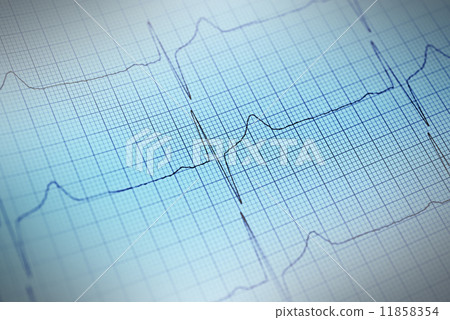 Electrocardiogram 11858354