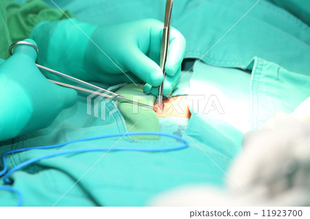 Surgeon hands suturing an hernia 11923700