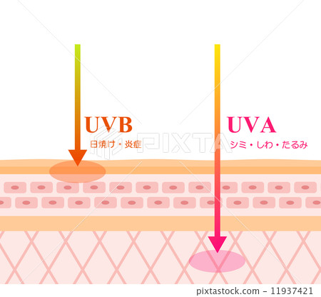 A cross-sectional explanation of how UV rays irritate the skin 11937421