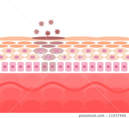 皮膚粗糙的部分 11937440