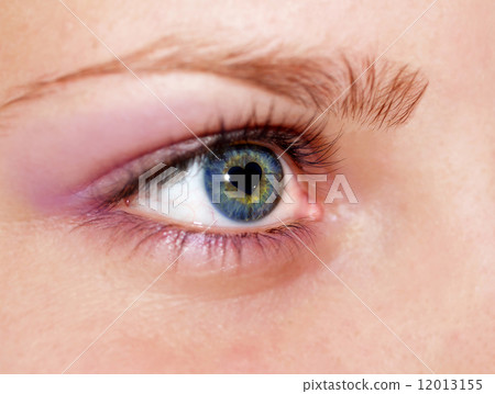 Heart in eye 12013155