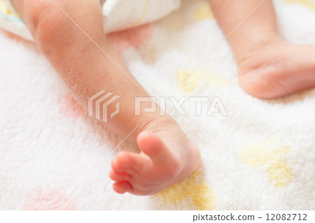 1 month after birth 12082712