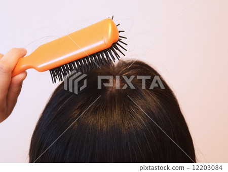 Image of hair loss 12203084