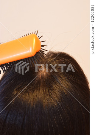 Image of hair loss Image of hair loss 12203085
