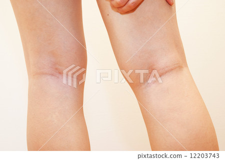 Female legs of forties 12203743