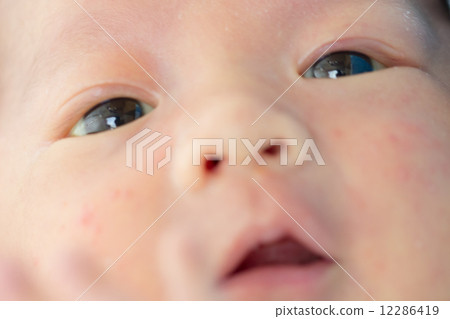 1 month old baby jaundice 12286419