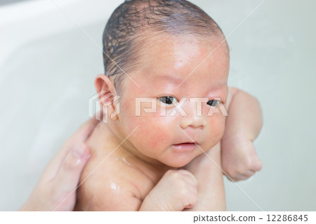 1 day after bathing 12286845