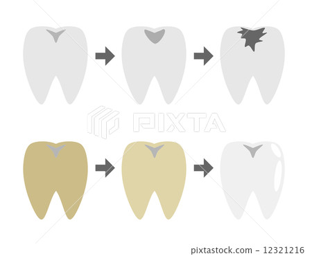 Tooth change Tooth change 12321216