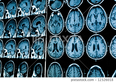 research in medicine. MRI scan of the patient. 12326018