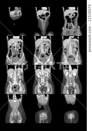 research in medicine. MRI scan of the patient. 12326074