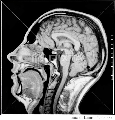 Magnetic resonance imaging 12409878