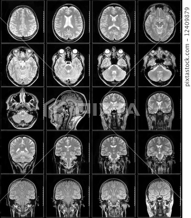 Magnetic resonance imaging 12409879