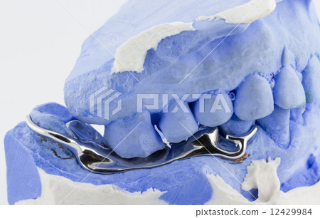 a partial denture on white background 12429984