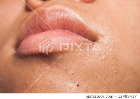 Blackheads on the jaw below lips 12498417